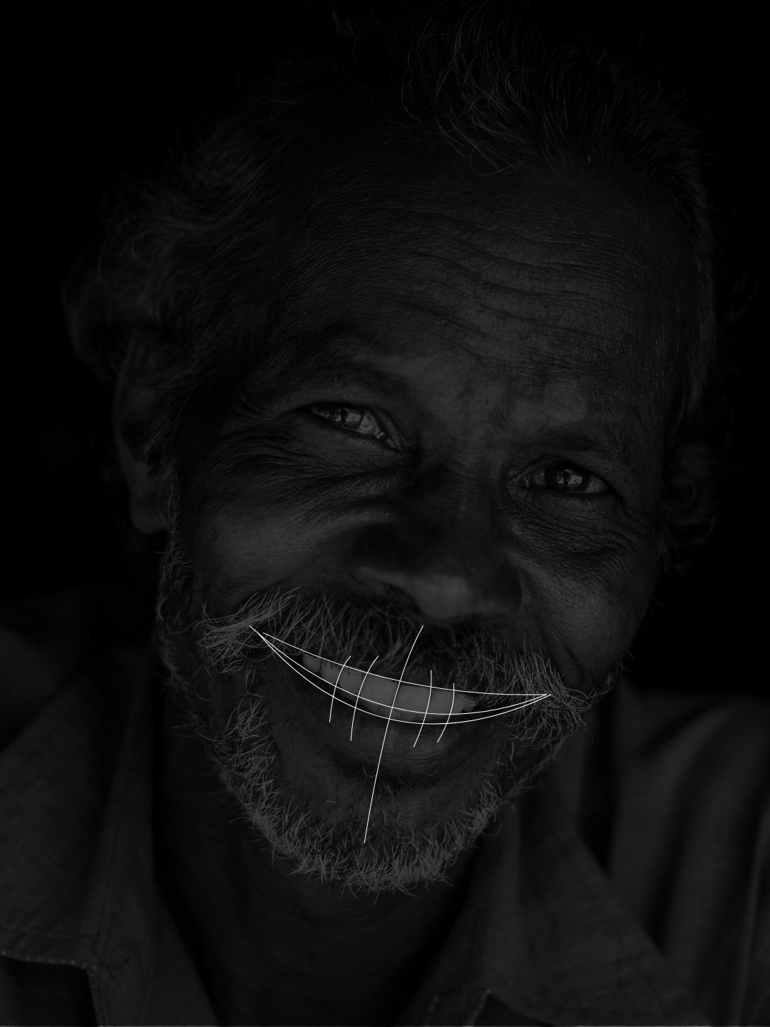 O mesmo sorriso com as linhas de análise estética sobrepostas